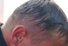 Cod Portocaliu de caniculă pentru județul Botoșani pe 1 iulie, între orele 10:00 – 21:00. Fenomenele vizate sunt: val de căldură intens și persistent, temperaturi deosebit de ridicate și disconfort termic